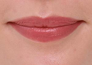 脂肪吸引が気になるならブログをチェック